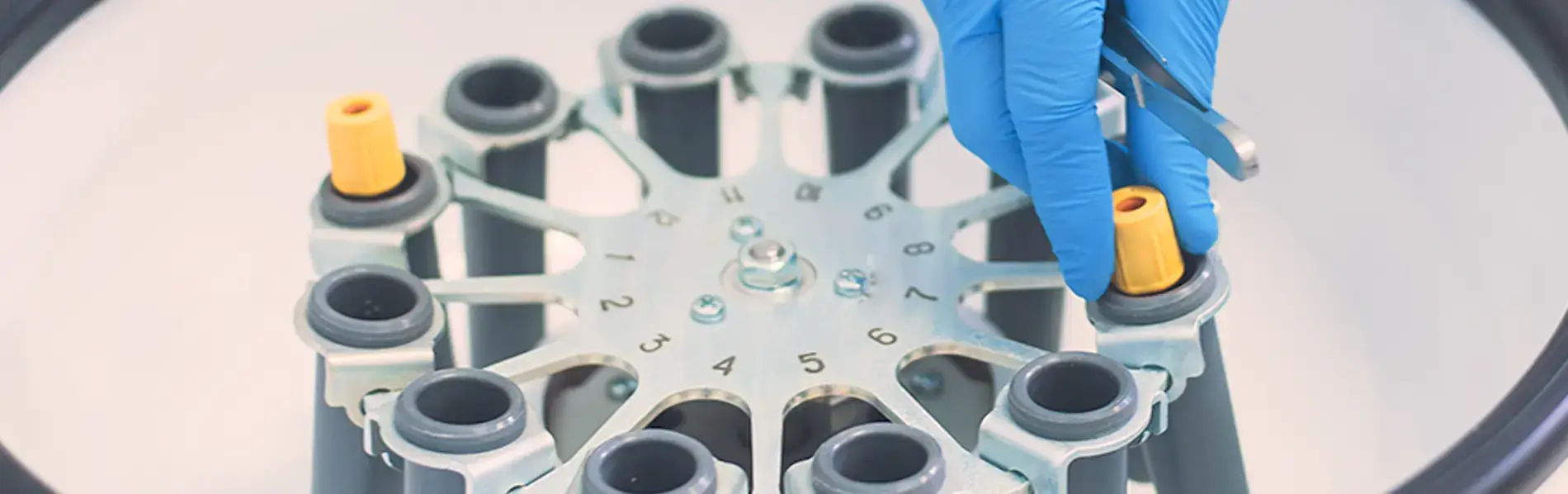 Platelet Rich Plasma PRP